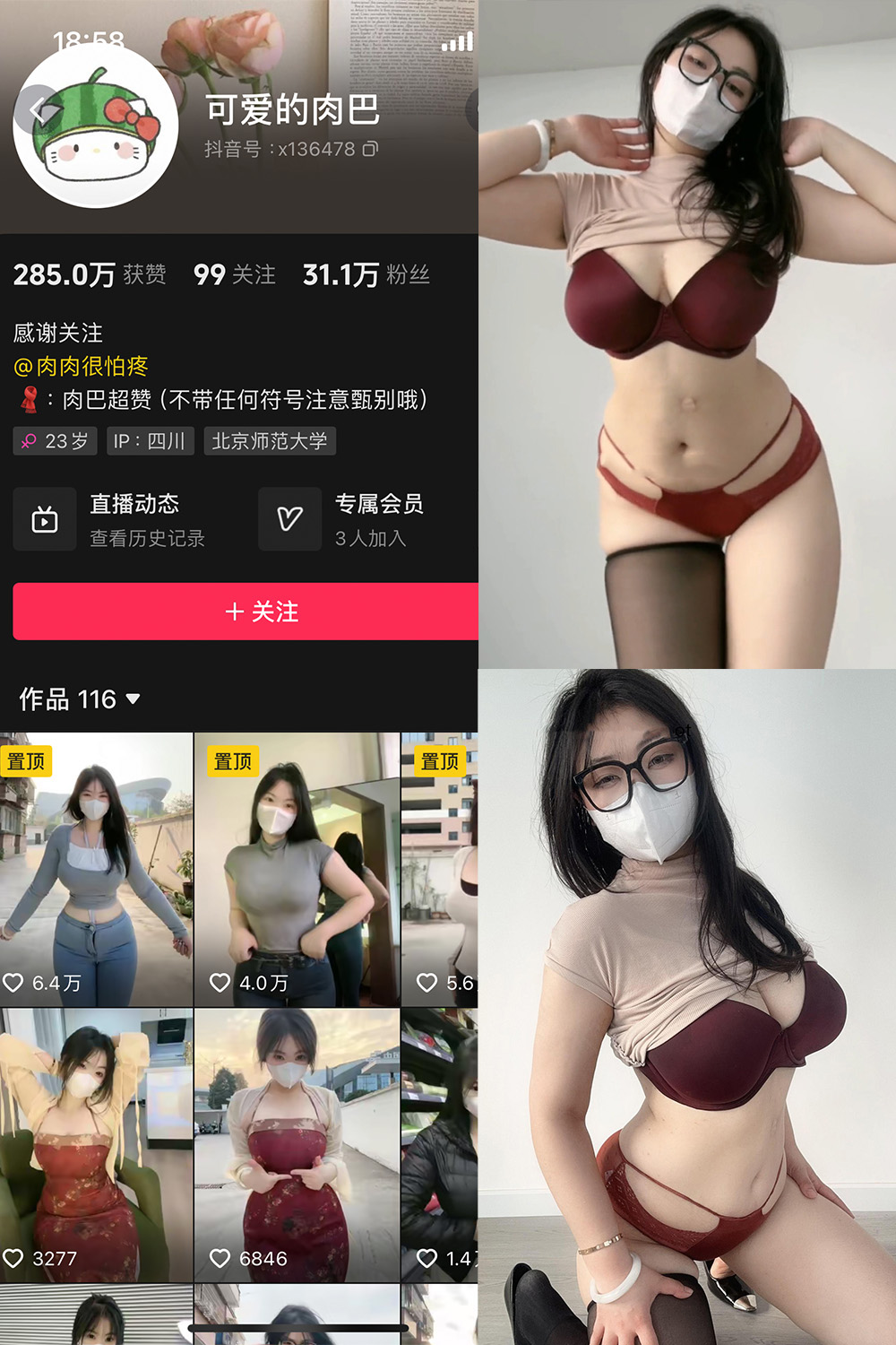 抖音 可爱的肉巴 微密圈 NO.0027期 【18P11V】最新至：2024.9.19 第1张